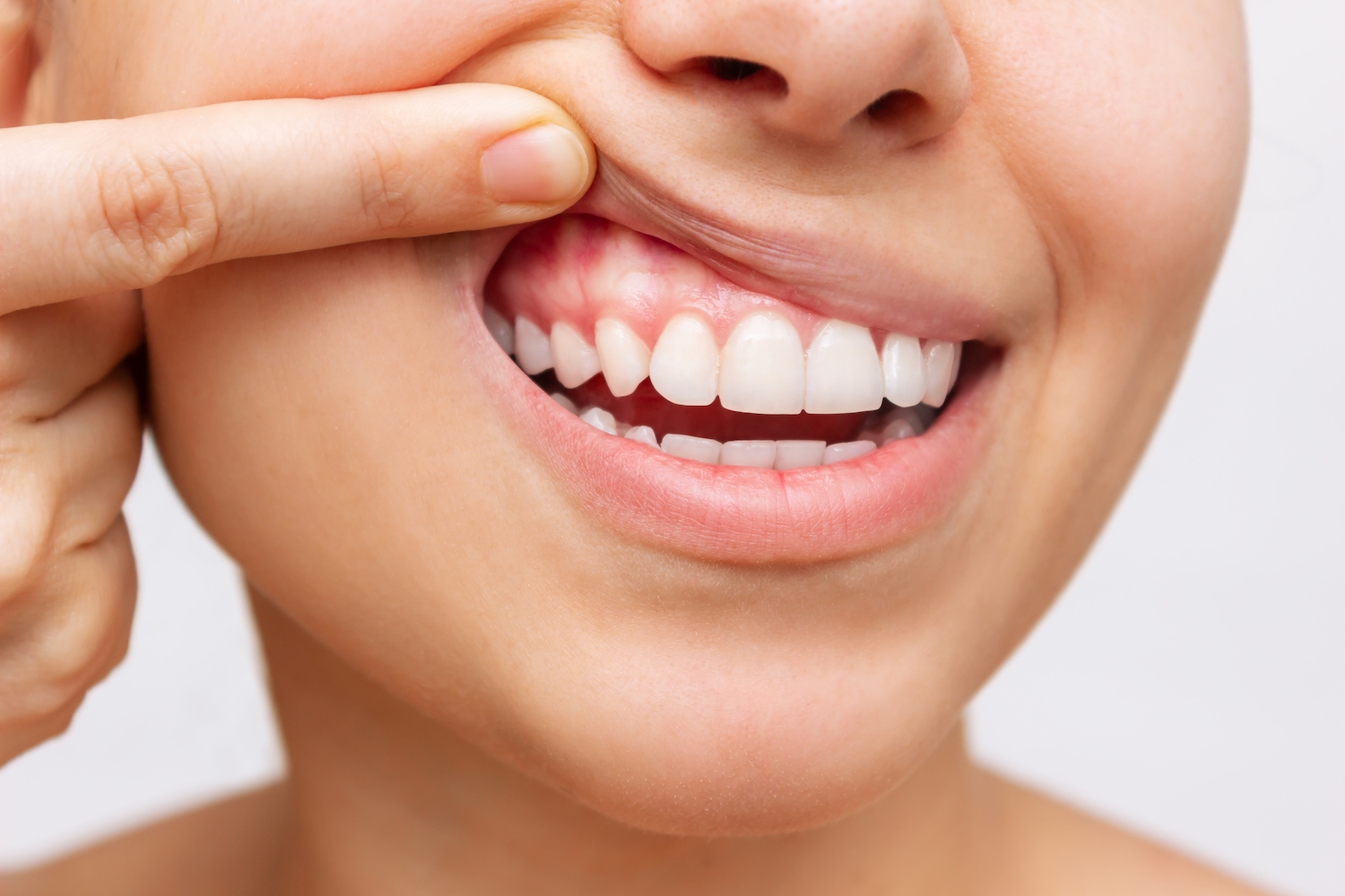 Incorporating Supplements into your Diet Plan for Better Tooth & Gum Health